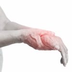 hand pijn en pols pijn laten behandelen door fysiotherapie nijmegen sport medisch centrum papendal
