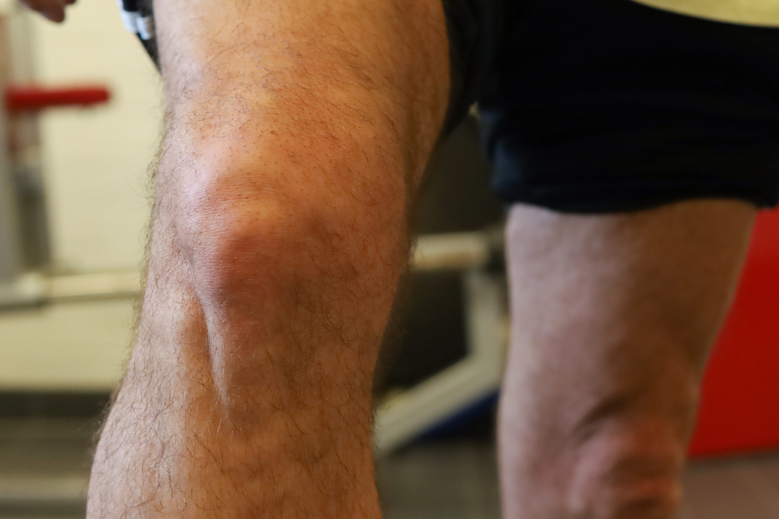 revalideren bij een nieuwe knie in fysiotherapie nijmegen van sport medisch centrum papendal